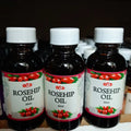 Rosehip - Essential Oil - 30ml